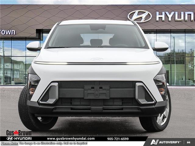 2026 Hyundai Kona 2.0L Essential (Stk: U438770) in Brooklin - Image 2 of 26