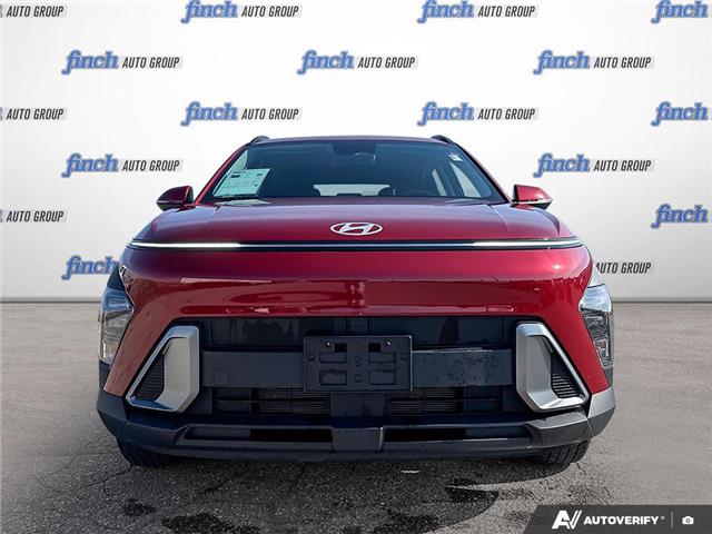 2024 Hyundai Kona 2.0L Preferred (Stk: 1005) in Kitchener - Image 2 of 24