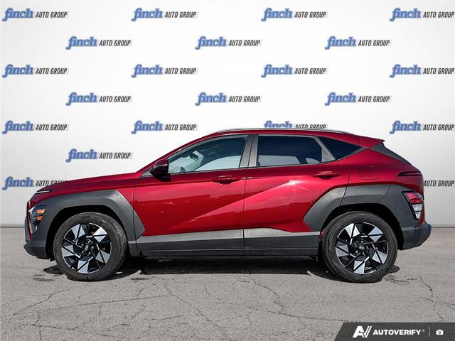 2024 Hyundai Kona 2.0L Preferred (Stk: 1005) in Kitchener - Image 3 of 24