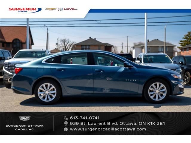 2025 Chevrolet Malibu 1LT (Stk: 26052A) in Ottawa - Image 5 of 20