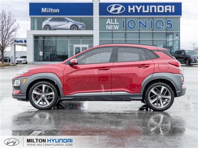 2021 Hyundai Kona 1.6T Ultimate w/Red Colour Pack (Stk: 704634) in Milton - Image 3 of 26