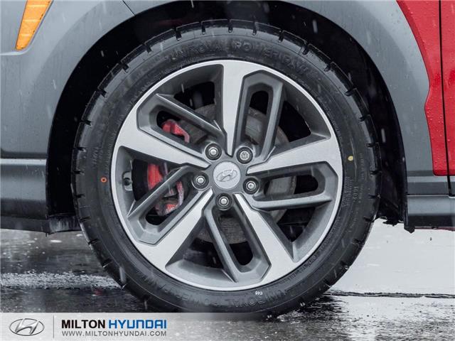2021 Hyundai Kona 1.6T Ultimate w/Red Colour Pack (Stk: 704634) in Milton - Image 4 of 26