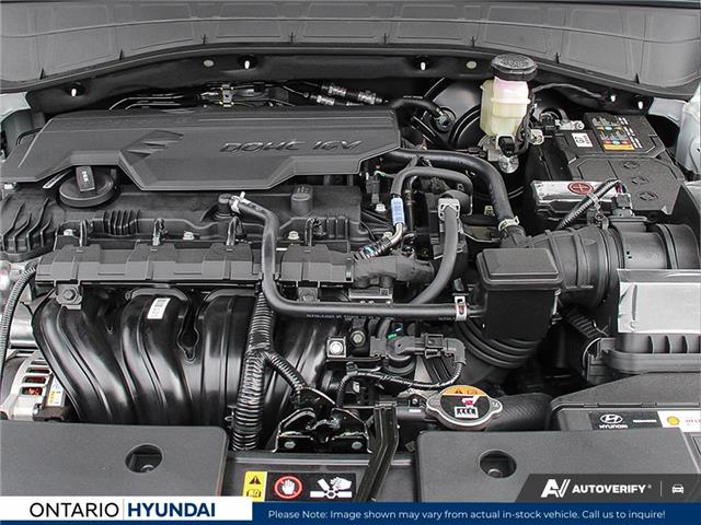 2026 Hyundai Kona 2.0L Preferred w/Trend Package (Stk: 7-1826) in Whitby - Image 6 of 25