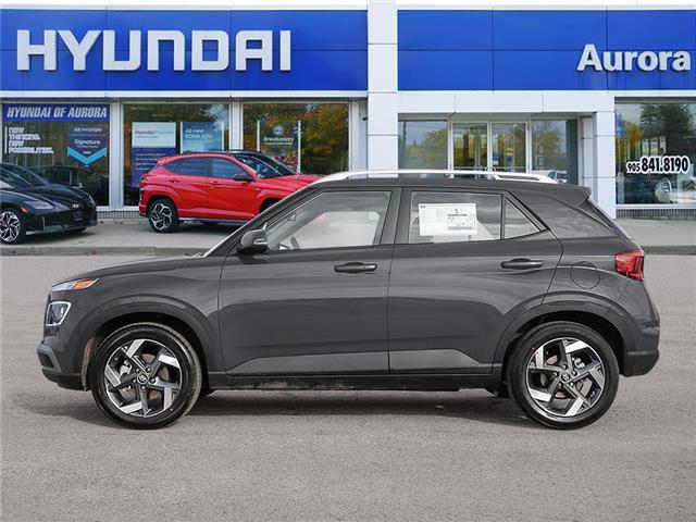 2026 Hyundai Venue Ultimate w/Black Interior (IVT) (Stk: 2610218) in Aurora - Image 3 of 21
