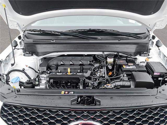 2026 Hyundai Venue Ultimate w/Black Interior (IVT) (Stk: 2610230) in Aurora - Image 6 of 22