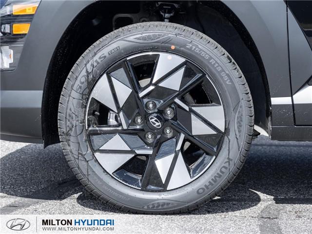 2026 Hyundai Kona Preferred (Stk: 454522) in Milton - Image 4 of 24