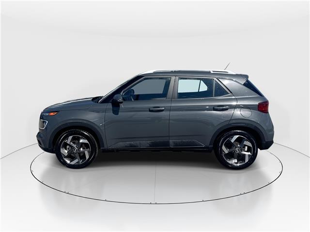 2025 Hyundai Venue Ultimate w/Black Interior (IVT) (Stk: 16U101707) in Markham - Image 5 of 27 2025 Hyundai Venue Ultimate w/Black Interior (IVT) (Stk: 16U101707) in Markham - Image 5 of 27