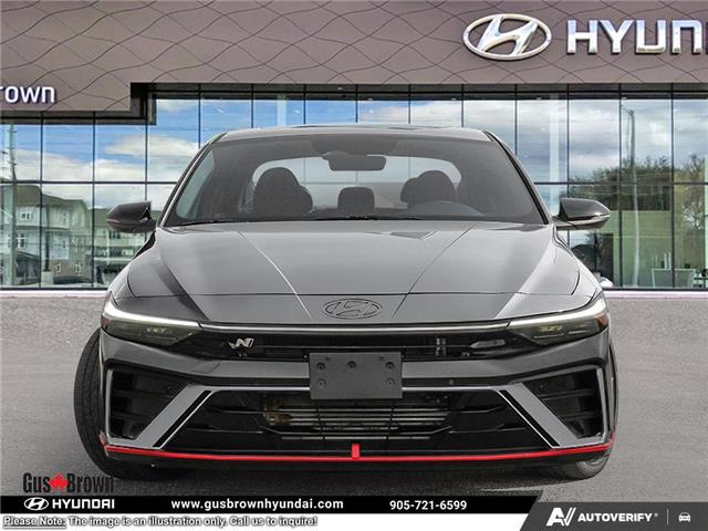 2025 Hyundai Elantra N Base (Stk: U033718) in Brooklin - Image 2 of 20