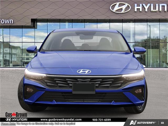 2025 Hyundai Elantra Preferred (Stk: U036884) in Brooklin - Image 2 of 23