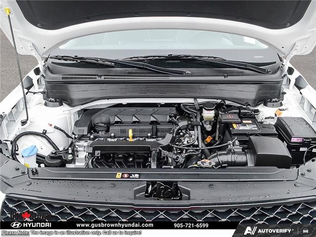 2026 Hyundai Venue Ultimate w/Black Interior (IVT) (Stk: U436410) in Brooklin - Image 6 of 24