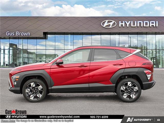 2026 Hyundai Kona 2.0L Preferred w/Trend Package (Stk: U417720) in Brooklin - Image 3 of 25