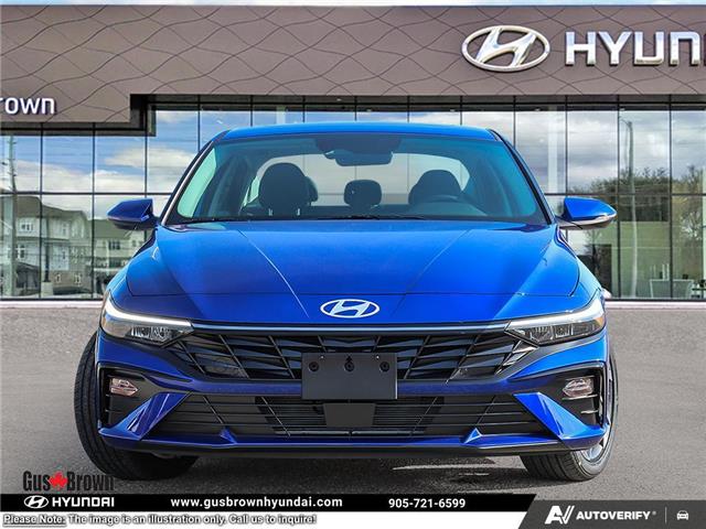 2026 Hyundai Elantra HEV Luxury w/Two-Tone Interior (Stk: U189653) in Brooklin - Image 2 of 24