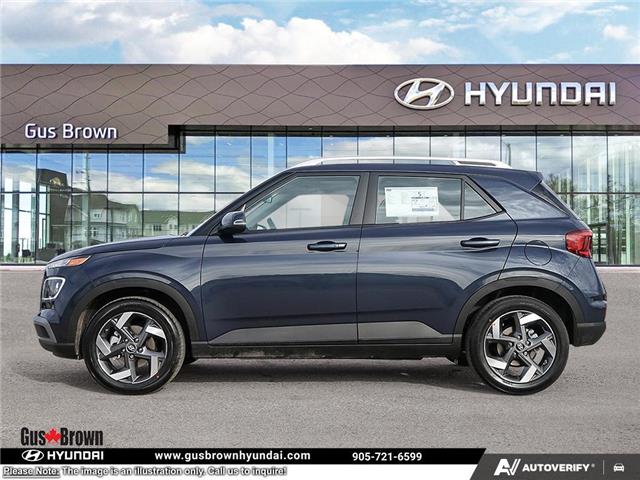 2026 Hyundai Venue Ultimate w/Denim Interior (IVT) (Stk: U451596) in Brooklin - Image 3 of 24