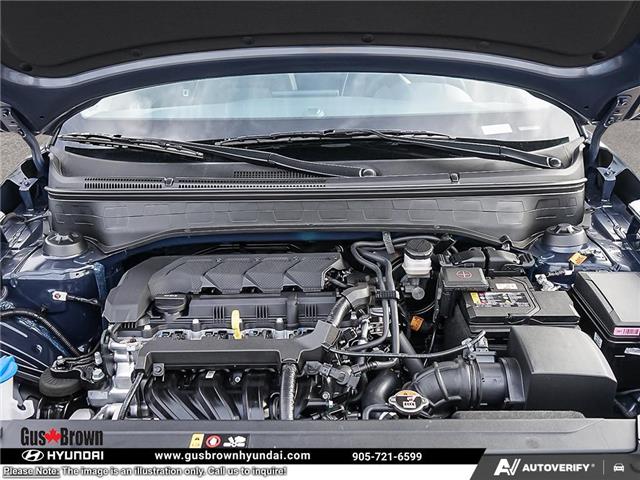 2026 Hyundai Venue Ultimate w/Denim Interior (IVT) (Stk: U451596) in Brooklin - Image 6 of 24