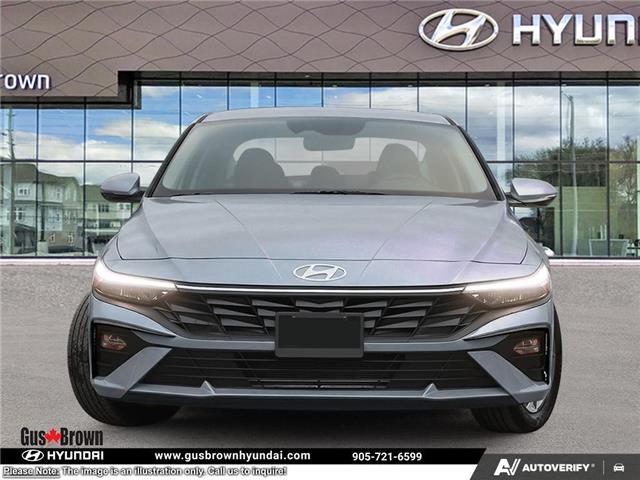 2026 Hyundai Elantra Preferred w/Tech Package (Stk: U159186) in Brooklin - Image 2 of 23