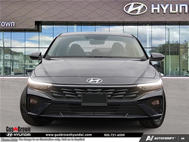 2026 Hyundai Elantra Preferred (Stk: U138880) in Brooklin - Image 2 of 23