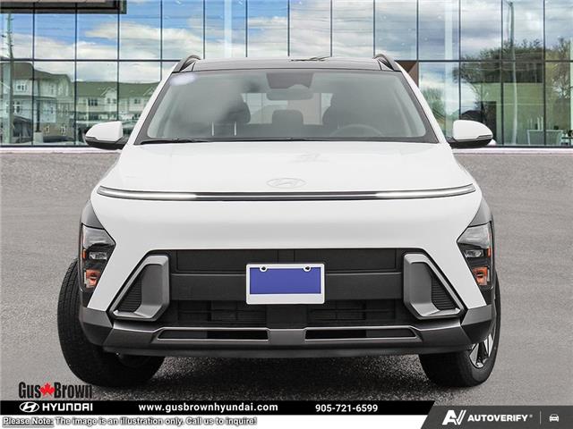 2026 Hyundai Kona 2.0L Preferred w/Trend Package (Stk: U455975) in Brooklin - Image 2 of 25
