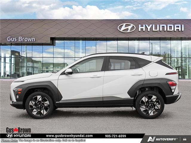2026 Hyundai Kona 2.0L Preferred w/Trend Package (Stk: U455975) in Brooklin - Image 3 of 25