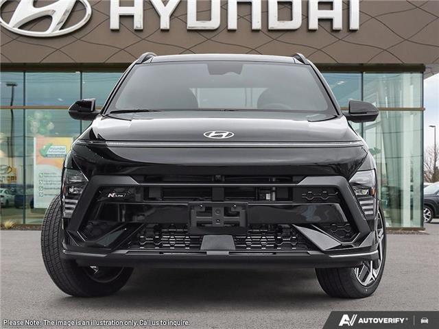 2024 Hyundai Kona 1.6T N Line Ultimate (Stk: 120109) in London - Image 2 of 24 2024 Hyundai Kona 1.6T N Line Ultimate (Stk: 120109) in London - Image 2 of 24