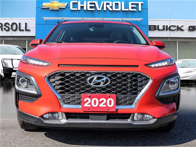 2020 Hyundai Kona  (Stk: 26260A) in Ingersoll - Image 2 of 27