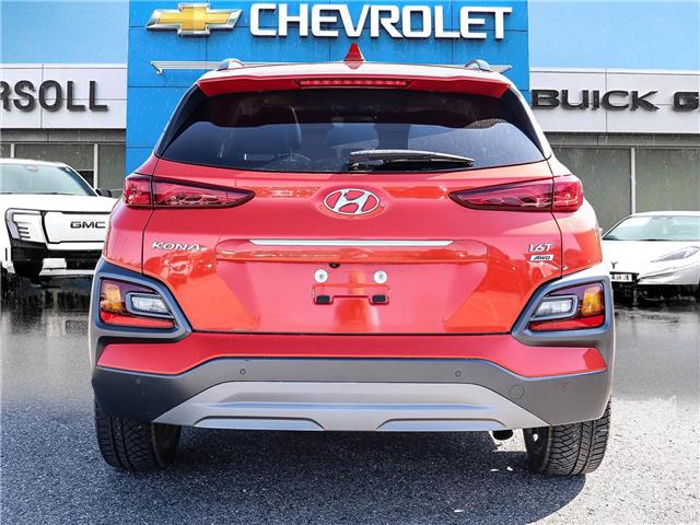 2020 Hyundai Kona  (Stk: 26260A) in Ingersoll - Image 4 of 27