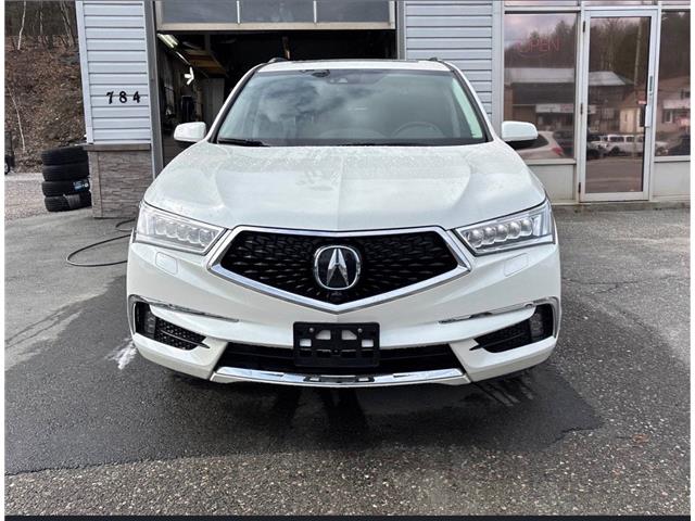 2018 Acura MDX Elite Package (Stk: 12378) in Greater Sudbury - Image 2 of 10