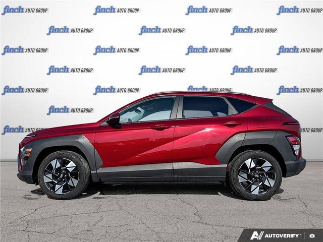 2024 Hyundai Kona 2.0L Preferred (Stk: 1005) in Kitchener - Image 3 of 24