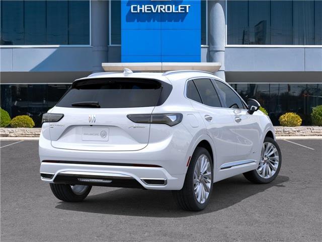 2026 Buick Envision Avenir (Stk: 154419) in London - Image 4 of 24
