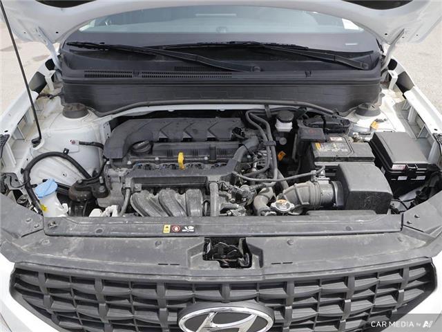2024 Hyundai Venue Preferred (Stk: 121310) in London - Image 6 of 25