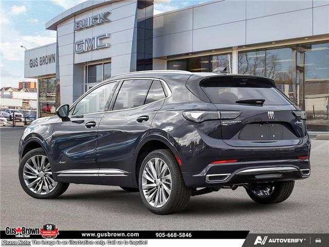 2026 Buick Envision Avenir (Stk: D066416) in WHITBY - Image 4 of 25 2026 Buick Envision Avenir (Stk: D066416) in WHITBY - Image 4 of 25