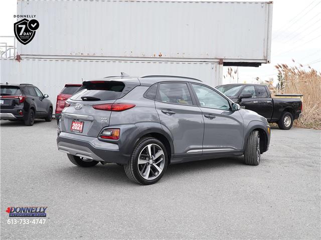 2021 Hyundai Kona Ultimate (Stk: MA14B) in Ottawa - Image 3 of 25