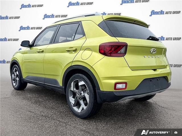 2020 Hyundai Venue Ultimate w/Grey-Lime Interior (Stk: 1096) in Kitchener - Image 4 of 24 2020 Hyundai Venue Ultimate w/Grey-Lime Interior (Stk: 1096) in Kitchener - Image 4 of 24