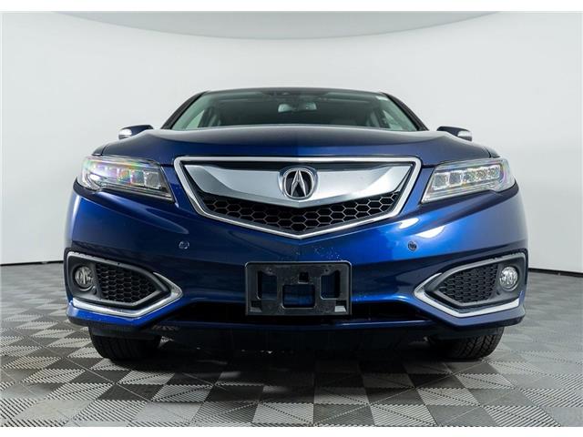 2018 Acura RDX Elite (Stk: TU0274) in Calgary - Image 9 of 24 2018 Acura RDX Elite (Stk: TU0274) in Calgary - Image 9 of 24