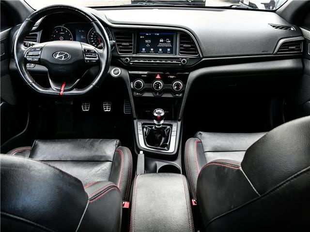 2019 Hyundai Elantra Sport (Stk: 260314A) in Mississauga - Image 20 of 20