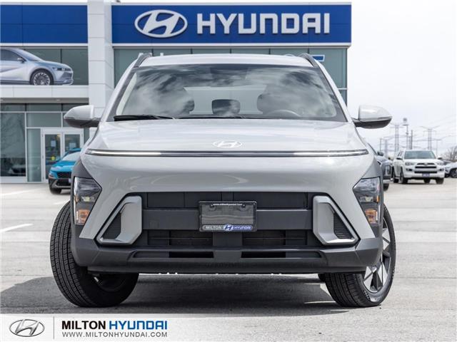 2026 Hyundai Kona 2.0L Preferred (Stk: 375282) in Milton - Image 2 of 22 2026 Hyundai Kona 2.0L Preferred (Stk: 375282) in Milton - Image 2 of 22