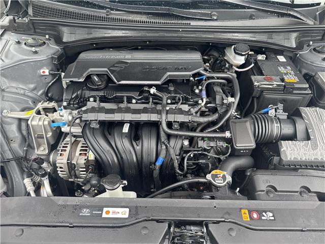2026 Hyundai Elantra Preferred (Stk: 16U101718) in Markham - Image 11 of 28 2026 Hyundai Elantra Preferred (Stk: 16U101718) in Markham - Image 11 of 28