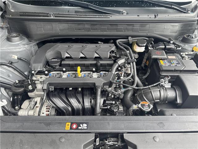 2025 Hyundai Venue Ultimate w/Black Interior (IVT) (Stk: 16U101707) in Markham - Image 11 of 27 2025 Hyundai Venue Ultimate w/Black Interior (IVT) (Stk: 16U101707) in Markham - Image 11 of 27