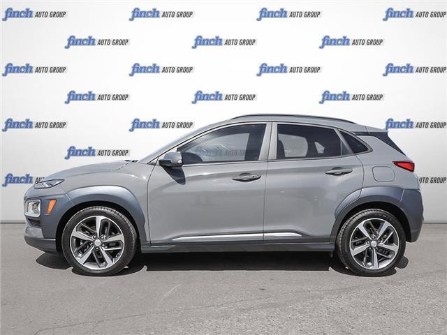 2021 Hyundai Kona 1.6T Ultimate (Stk: 98290) in London - Image 3 of 26