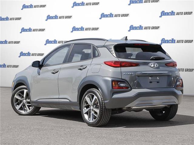 2021 Hyundai Kona 1.6T Ultimate (Stk: 98290) in London - Image 4 of 26