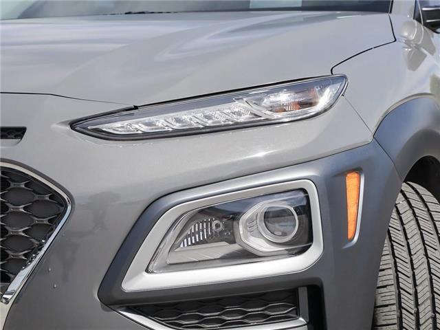 2021 Hyundai Kona 1.6T Ultimate (Stk: 98290) in London - Image 10 of 26
