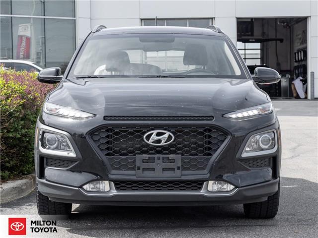 2018 Hyundai Kona 2.0L Preferred (Stk: 157411) in Milton - Image 2 of 23 2018 Hyundai Kona 2.0L Preferred (Stk: 157411) in Milton - Image 2 of 23