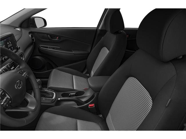 2021 Hyundai Kona 2.0L Essential (Stk: TU0301) in Calgary - Image 6 of 12
