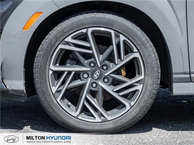 2023 Hyundai Kona 1.6T N Line (Stk: 999667) in Milton - Image 4 of 24