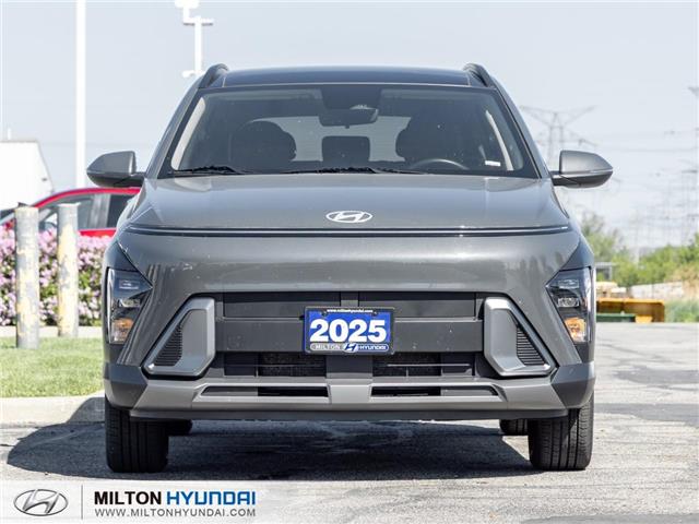 2025 Hyundai Kona 2.0L Preferred w/Trend Package (Stk: 287902) in Milton - Image 2 of 26
