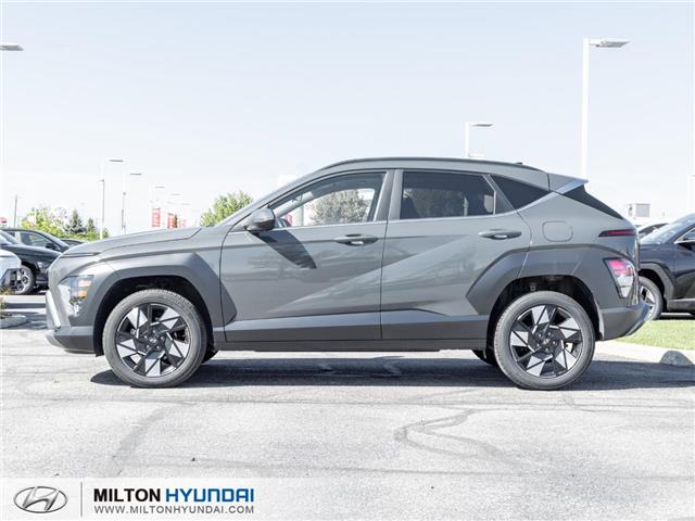 2025 Hyundai Kona 2.0L Preferred w/Trend Package (Stk: 287902) in Milton - Image 3 of 26