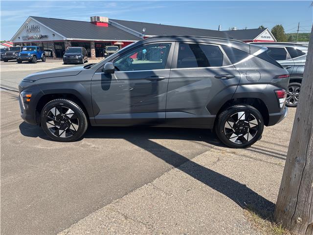 2025 Hyundai Kona  (Stk: 25588A) in Oak Bay - Image 4 of 10