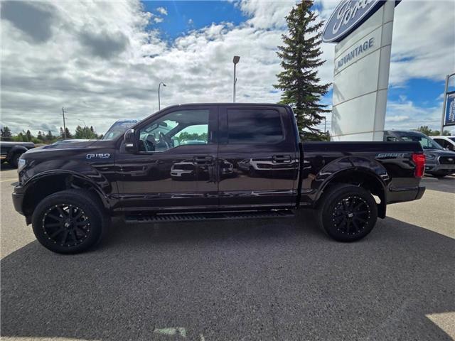 2018 Ford F-150 Lariat (Stk: TA-421B) in Calgary - Image 3 of 15
