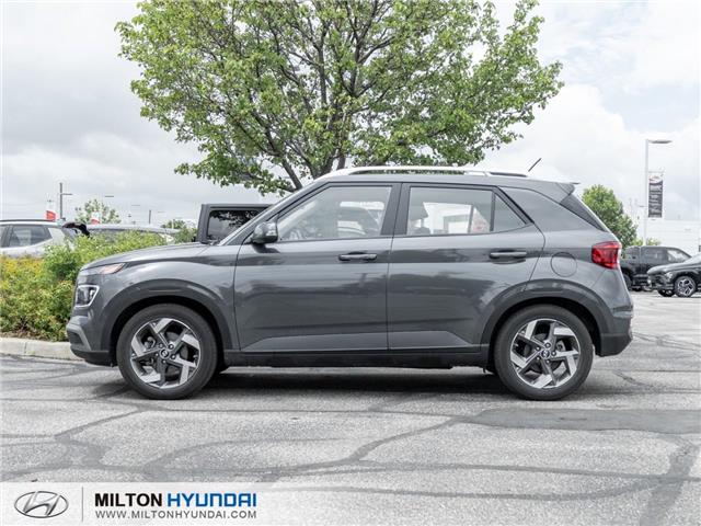 2024 Hyundai Venue Ultimate w/Black Interior (IVT) (Stk: 296082) in Milton - Image 3 of 24