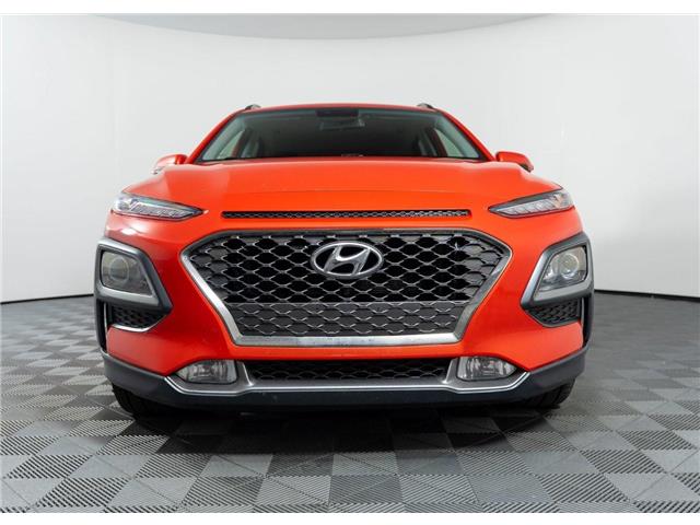 2019 Hyundai Kona 1.6T Trend (Stk: TU0274A) in Calgary - Image 2 of 26