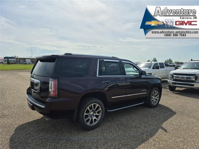 2017 GMC Yukon Denali (Stk: 45111A) in Fairview - Image 2 of 30